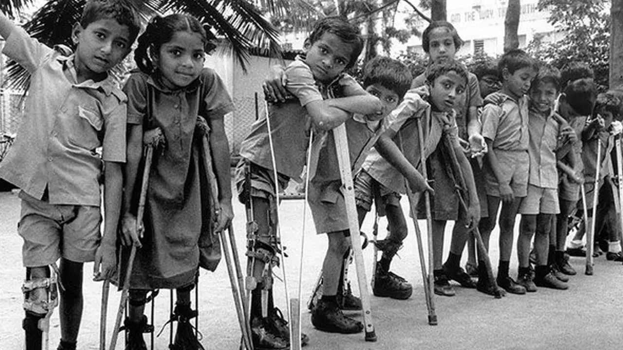 Mengungkap Misteri Sejarah Polio: Wabah yang Menggemparkan